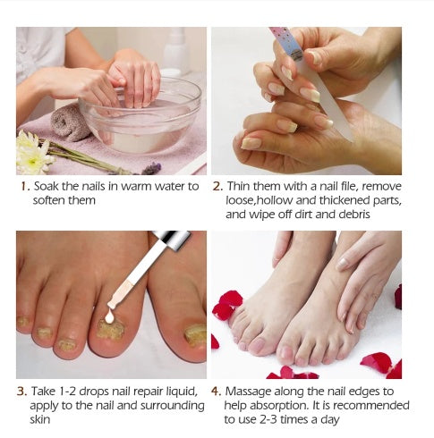 Nail Fungus Treatment Serum Fast Nail Repair