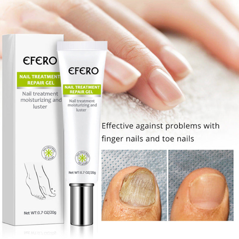 Nail Care Repair Gel 2 Pack